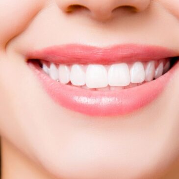 Know Before You Give It a Go: Facts about Teeth Whitening – Rye, NY